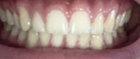 1660411225232