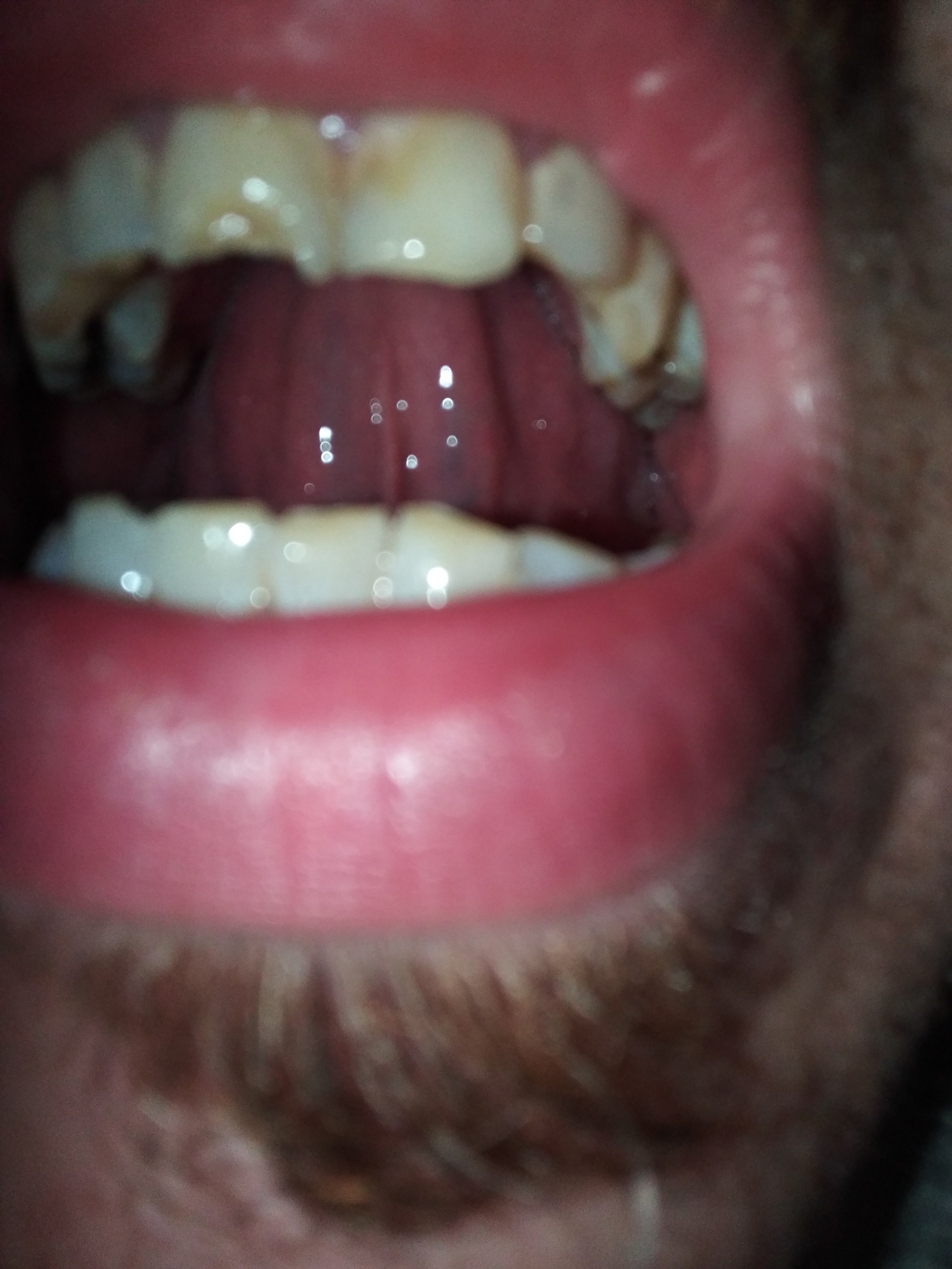 IMG 20220814 011456