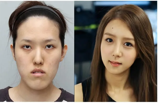 Plastic surgery 3