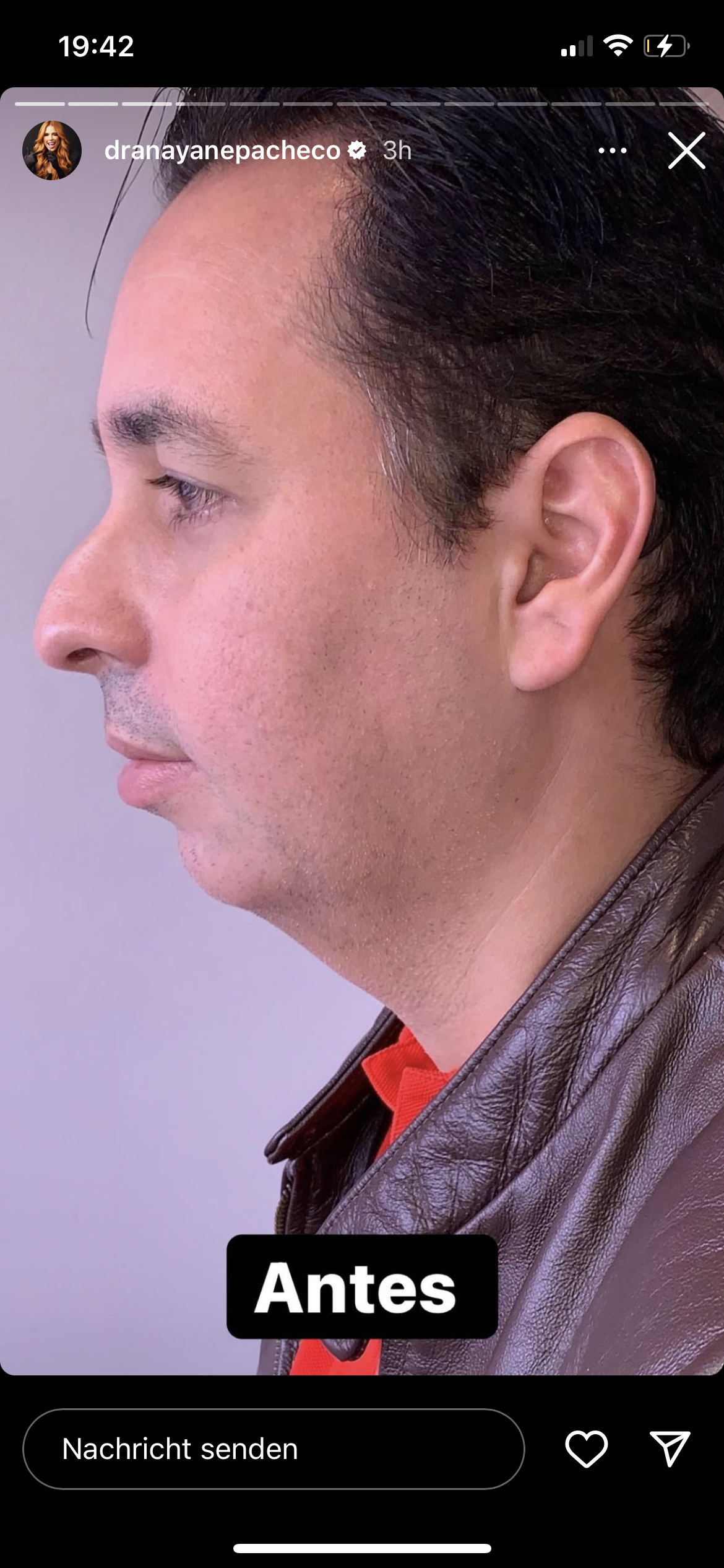 5A1D52B9 6B0D 45F1 B299 82019CD092B1