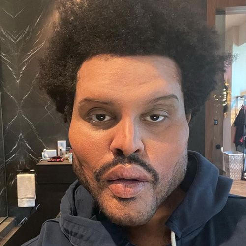 The weeknd face plastic surgery super bowl 2021 transformation 1612285955
