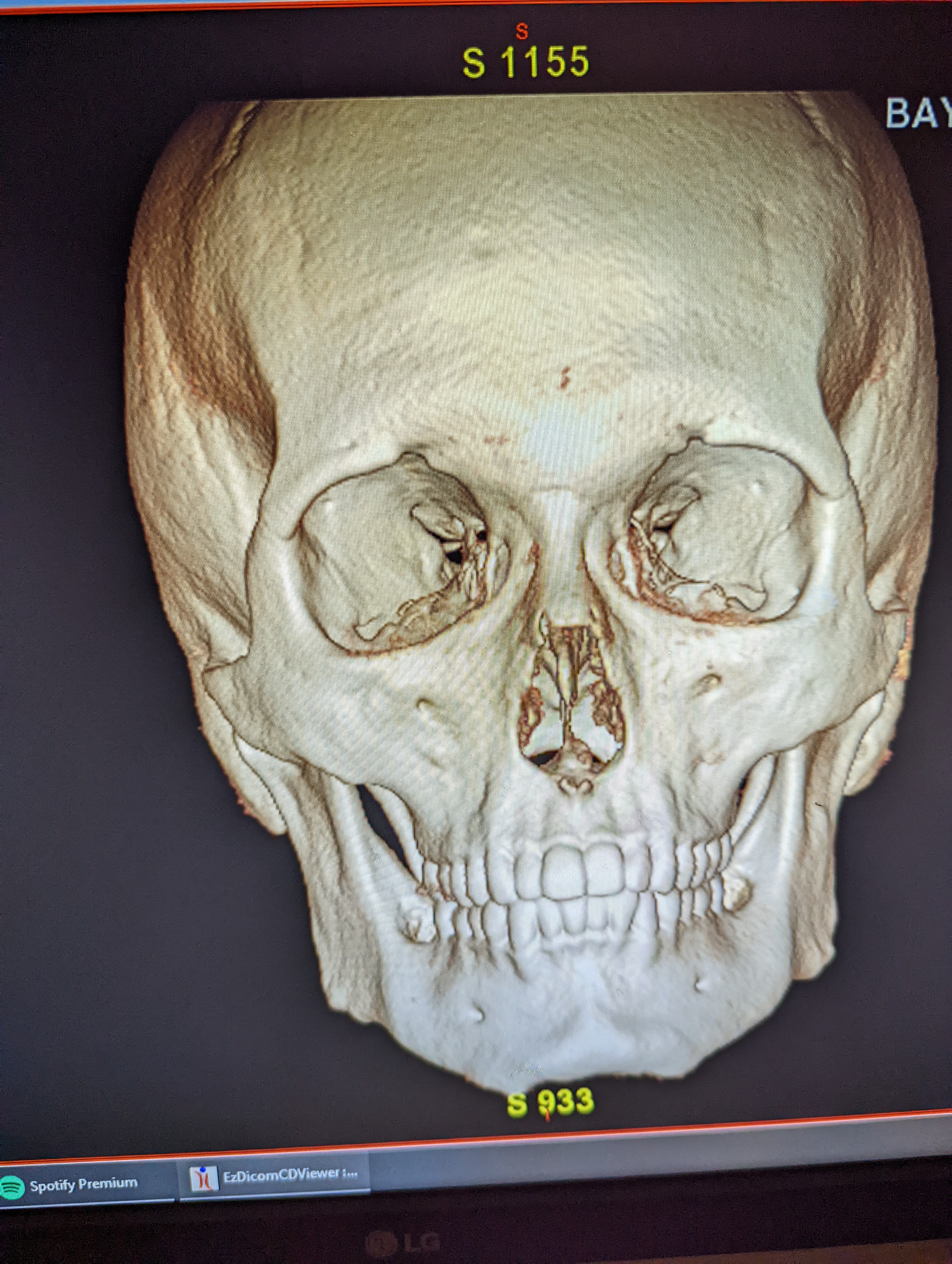 PXL 20220825 153156741MP