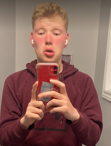 Er