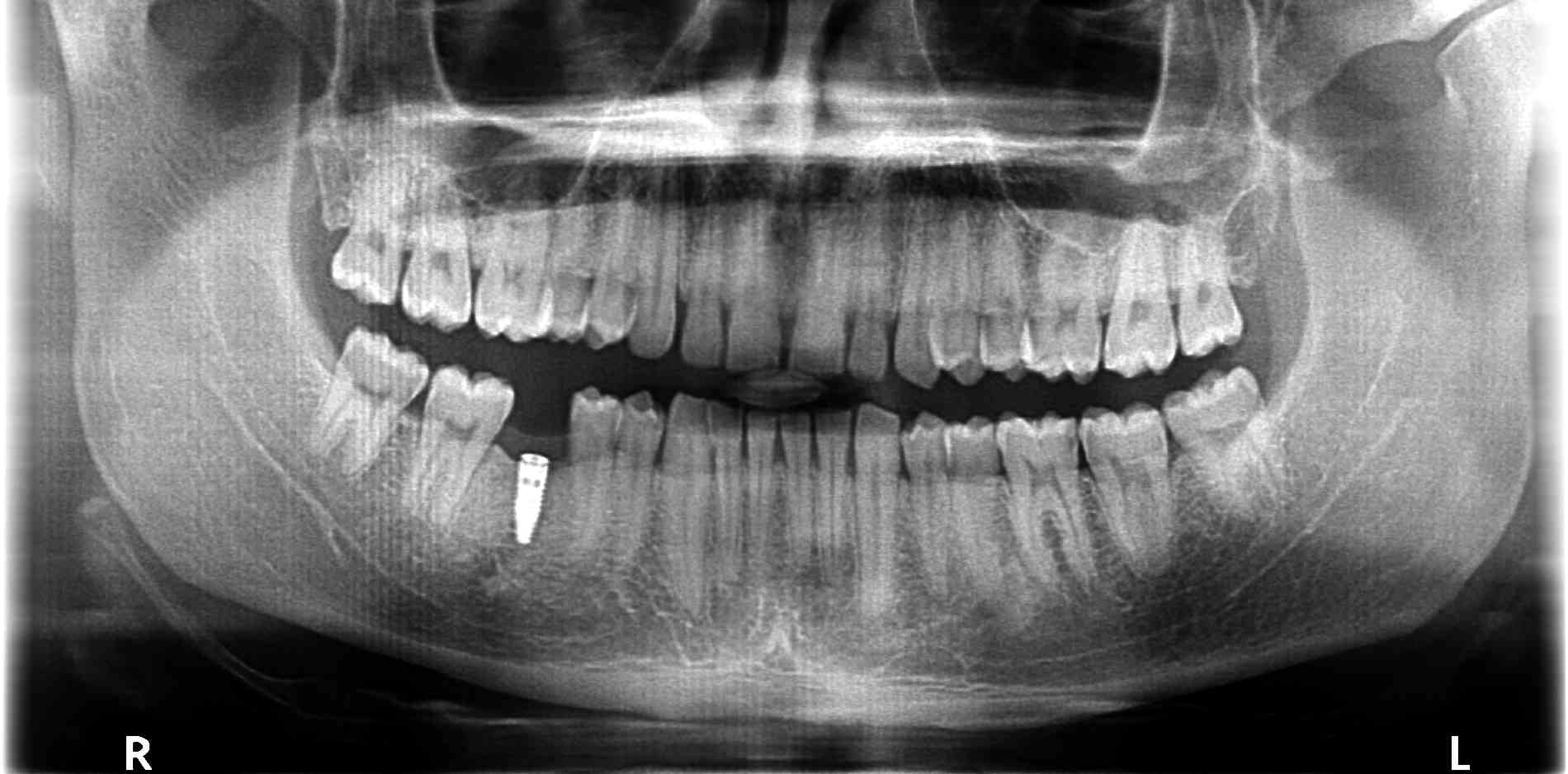 BEN DELRIO PANO BEN DELRIO PANO