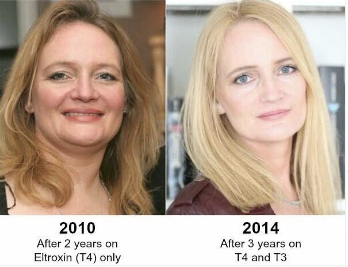 0714B35B F3B4 4484 9FEA A7B4B1CF7A1F