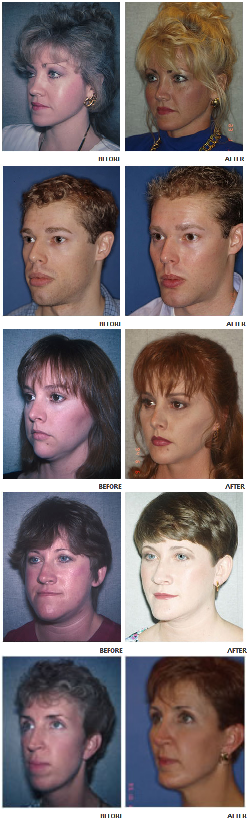 Dr t william evans cheeks