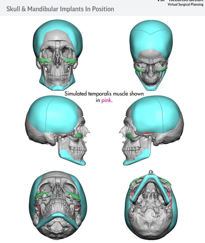 2623718 Screenshot from 2021 11 30 22 23 54