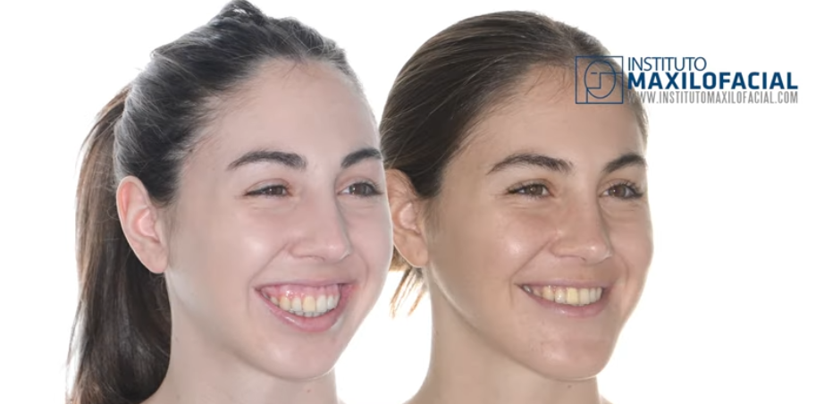 Instituto maxilofacial barcelona elena