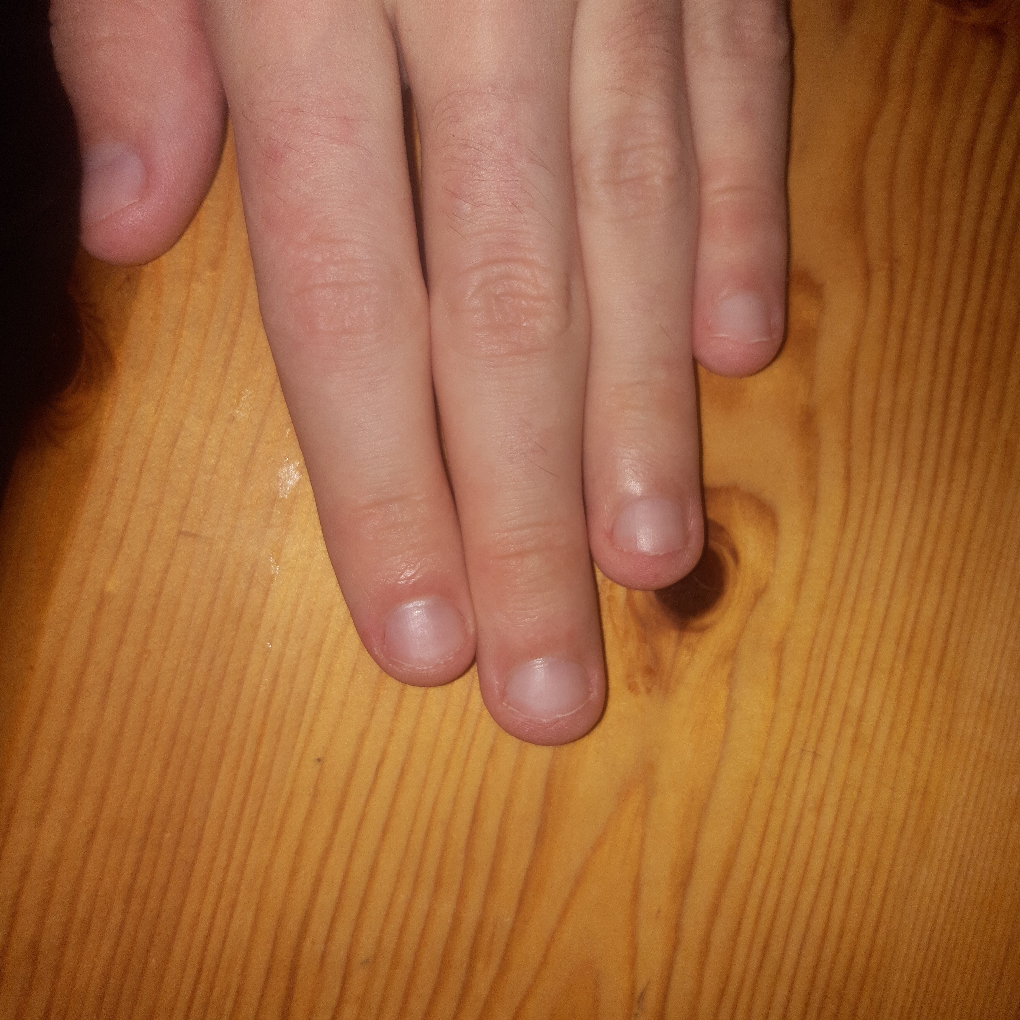Finger