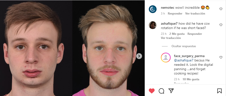 Raffaini comment