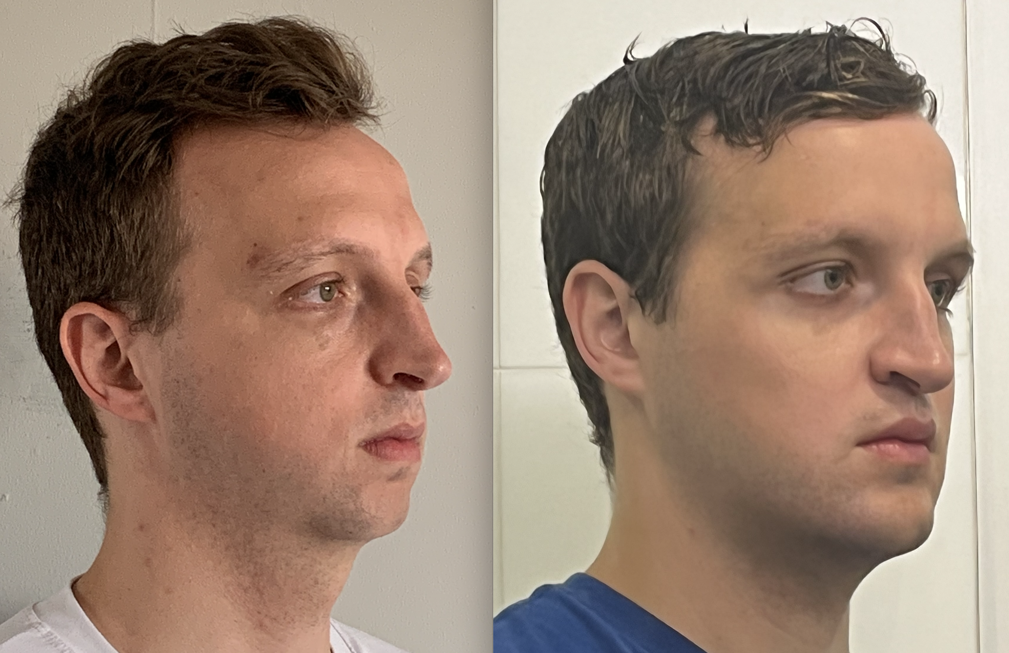 AD2D60B3 217A 49BB AF03 C98F468A46BE