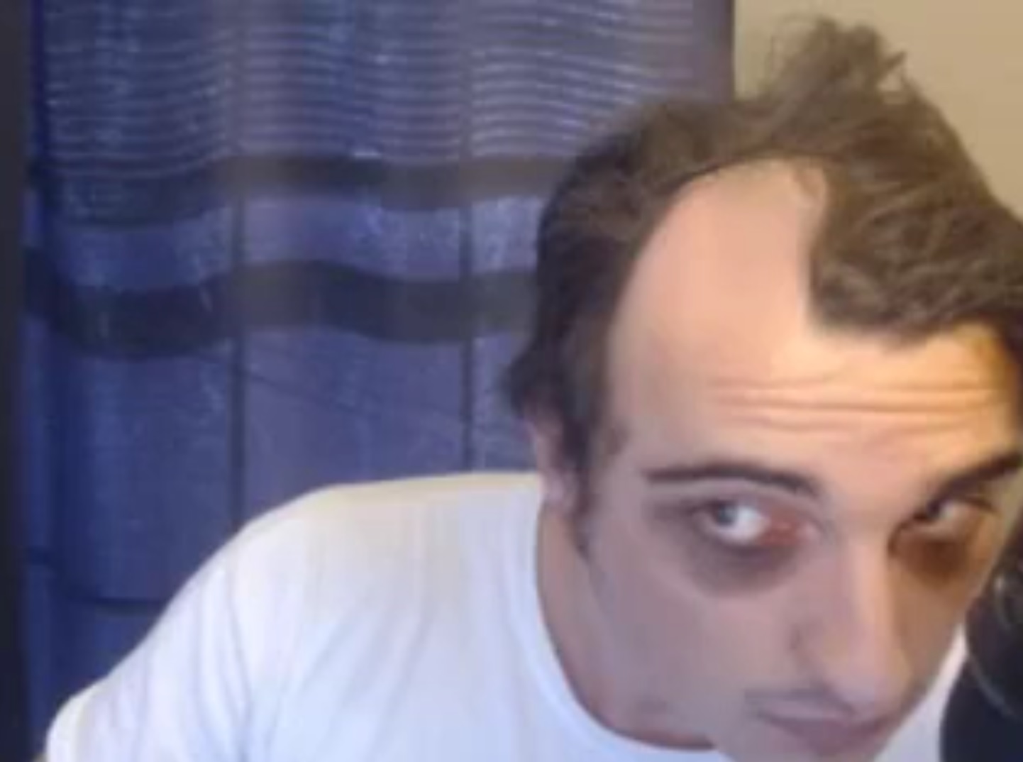 Man with racoon eyes