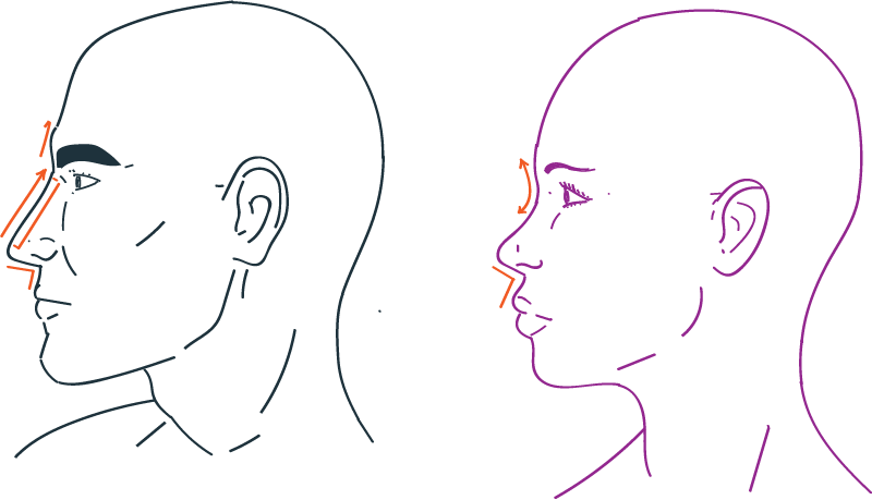 Nose rhinoplasty ffs