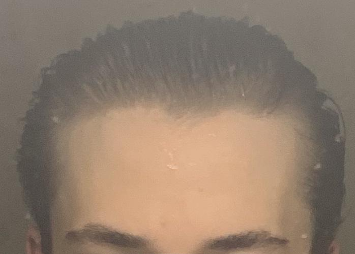 Hairline   Current