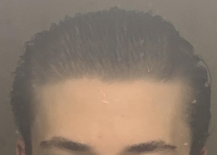 Morph   Hairline   Ideal