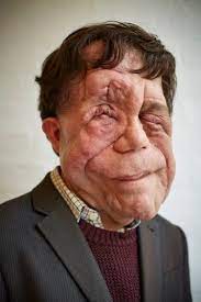  52