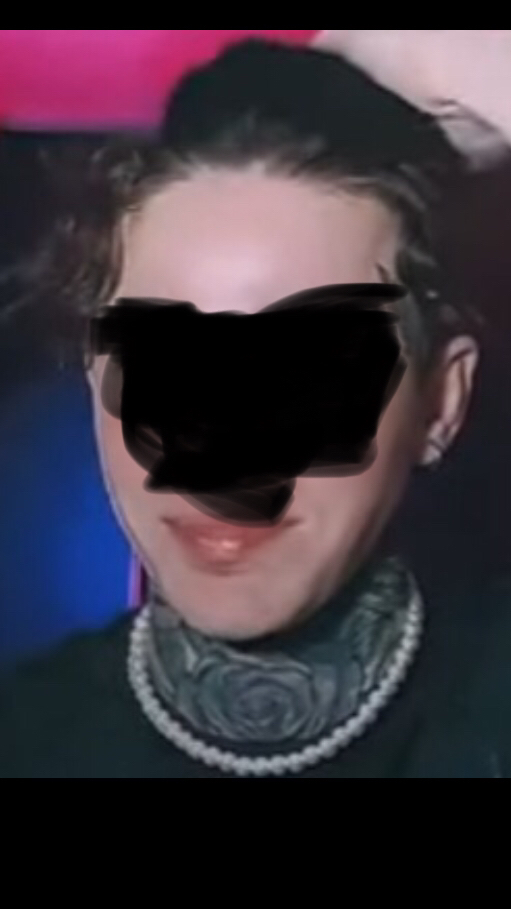 2871562 jaw help 2