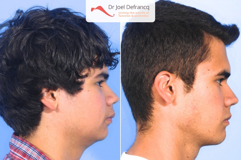 Dr Joel Defrancq 1457274102046258400 2015