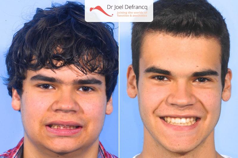 Dr Joel Defrancq 1457273981020278600 6259