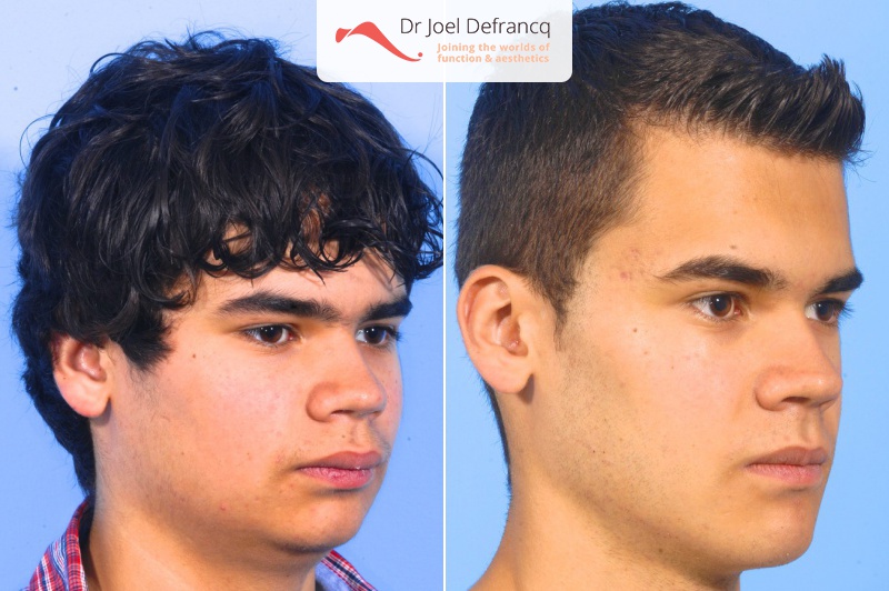 Dr Joel Defrancq 1457274259022570200 4966