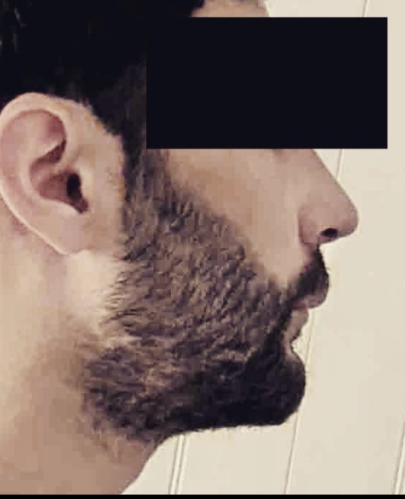 2D15C422 B46B 416A AEB6 28E0F2EE7E1E