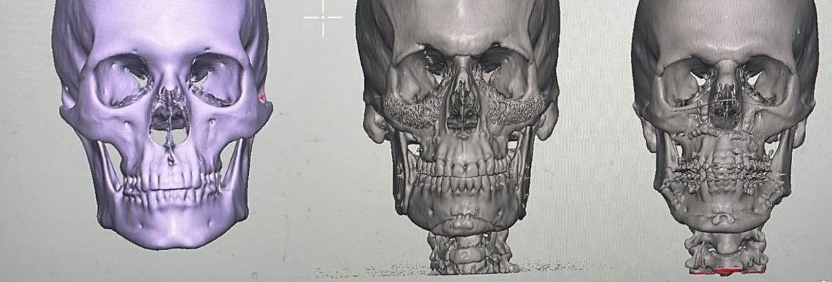 334AED20 870C 426D A339 210D7BF57C0C