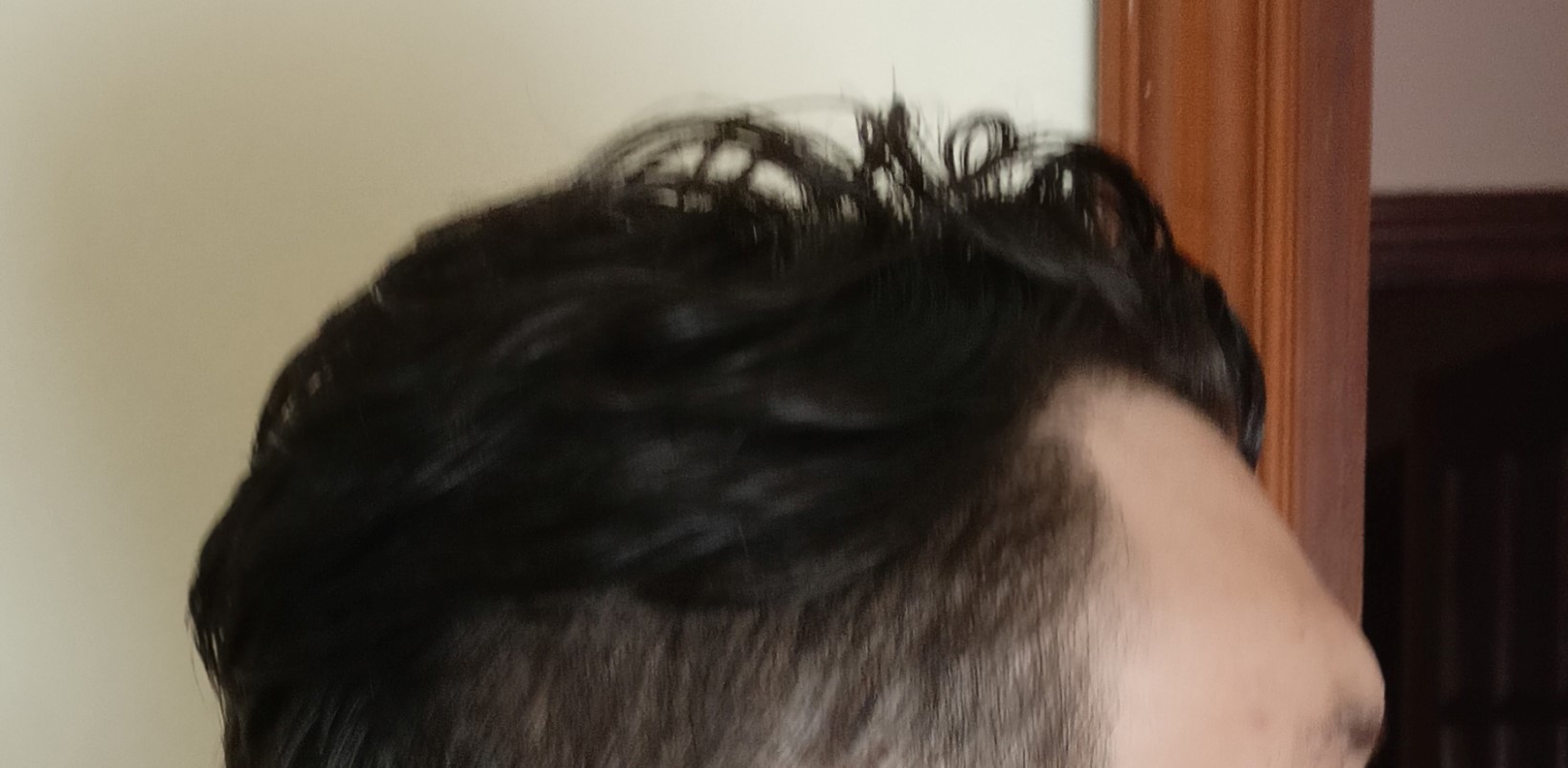 Forehead