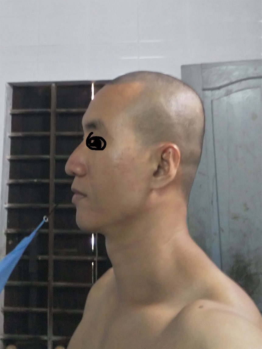 Shaved
