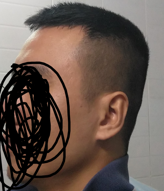 Hair
