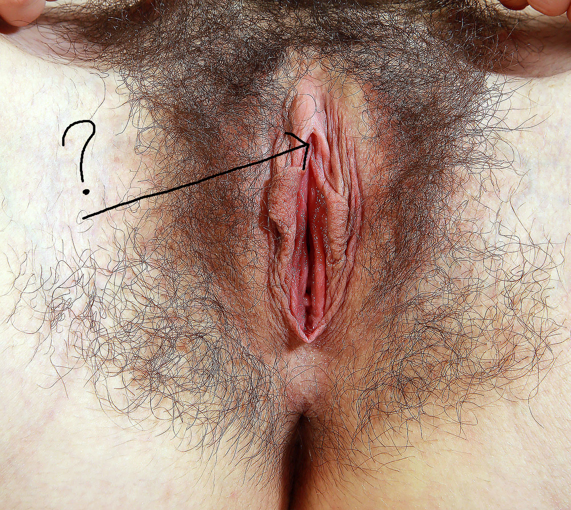 Vag