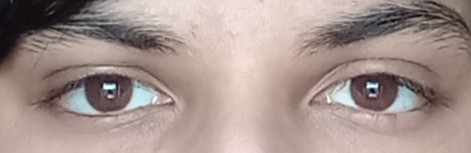 Snapchat 20562047022