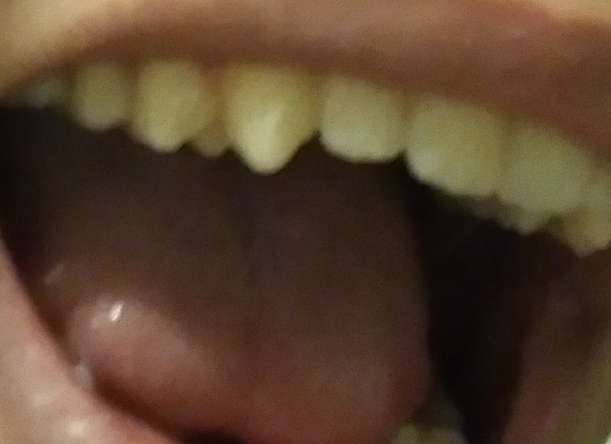 IMG 20220929 1136322