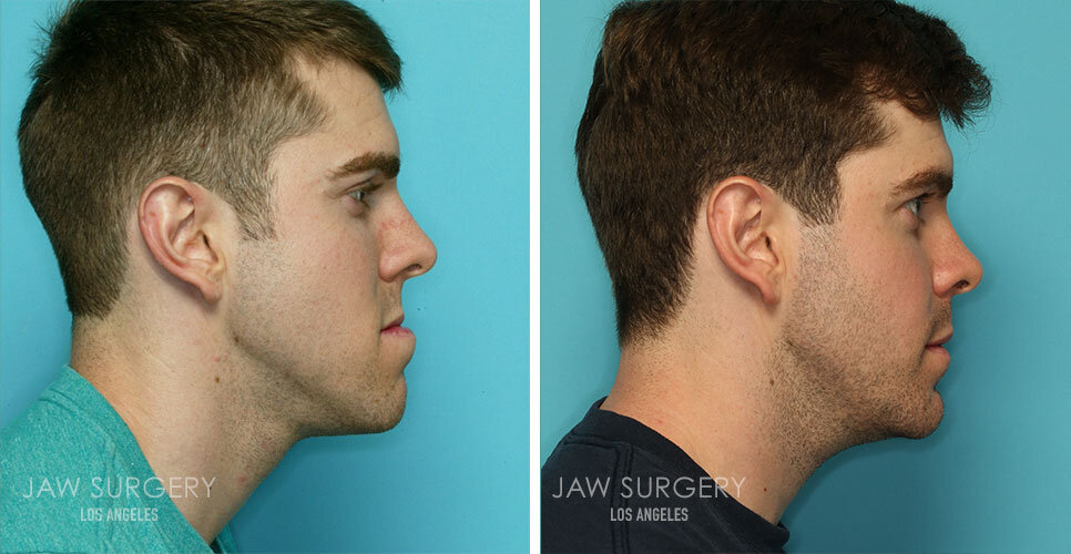 before-after-patients-17.jpg
