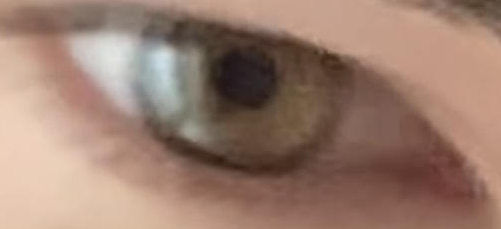My eye