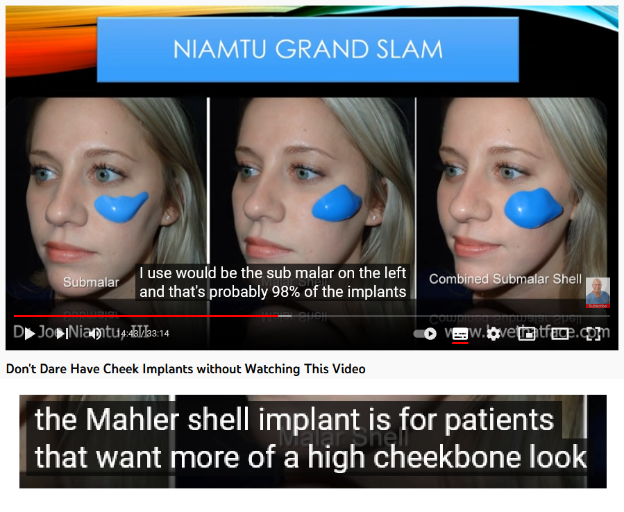 Joe niamtu on malar implants