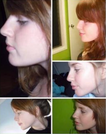 Ea01f8c5a2c9110bd9f5d4a0e91652cc 1