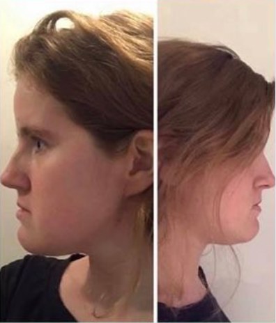 04d3b9b74f803de156a2e81f4e6408c9