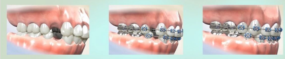 036babcd0f195f1e521858d762c94604