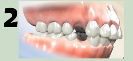 0496e33321d4c8fcb258b48b5a673dcd