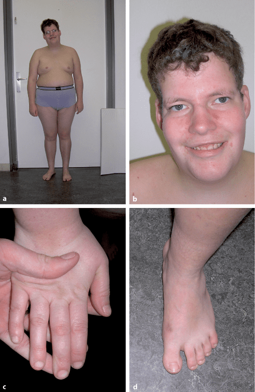 2 Figure1 1