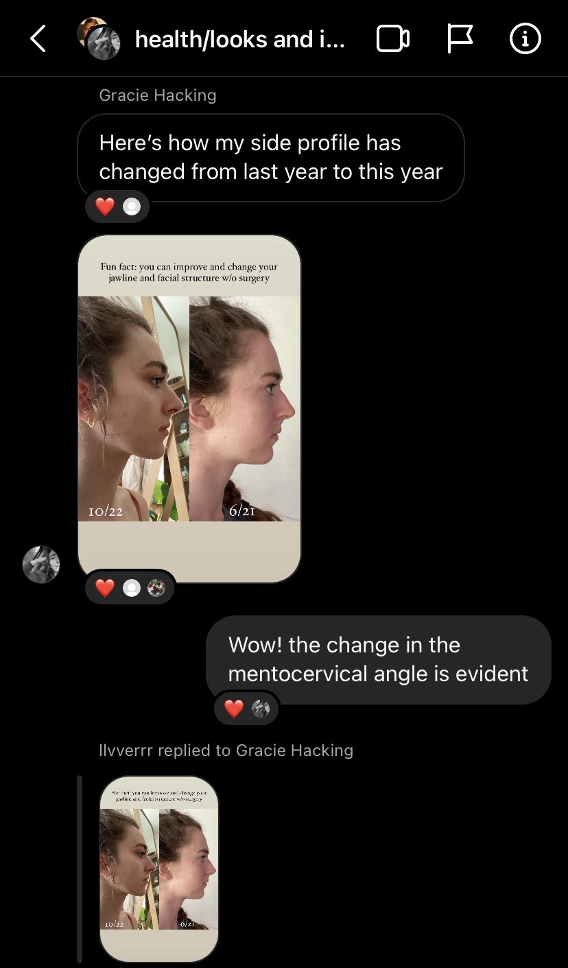 FfSpV4HXwAkRuU6
