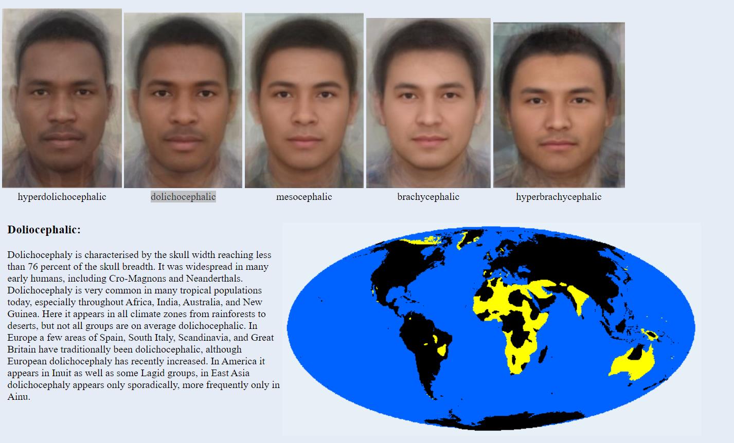 Dolichocephaly
