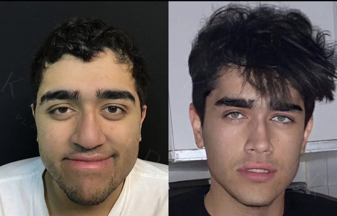 3078305 plastic surgery 4