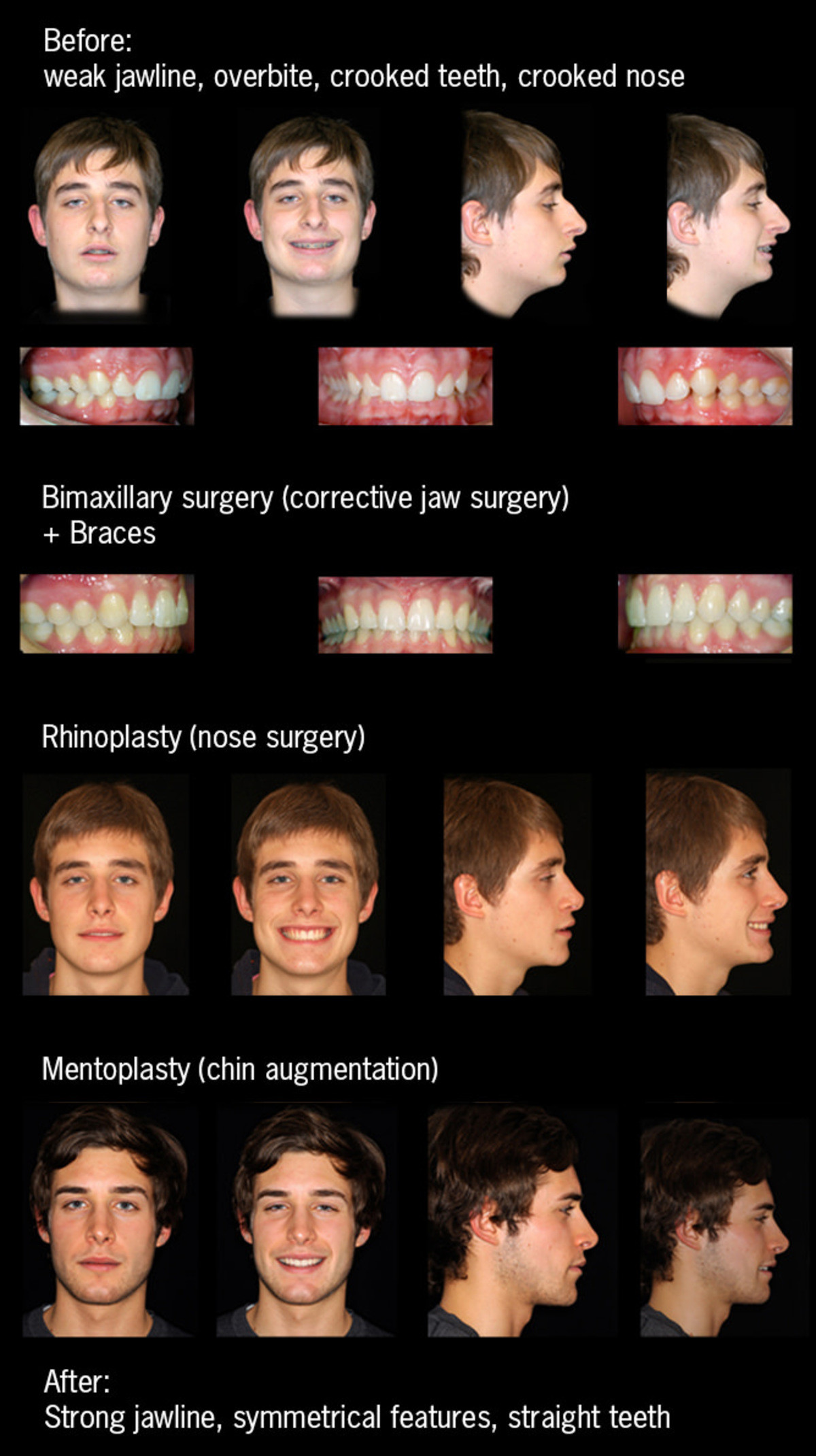 2885951 2694747 raffaini before and after 2