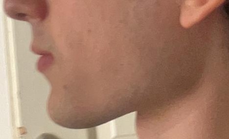 Jaw2