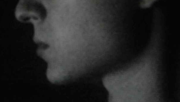 Jaw1