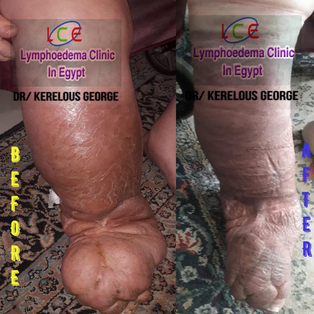 B8669035 CF96 41DE A616 EFC3D3544D0E