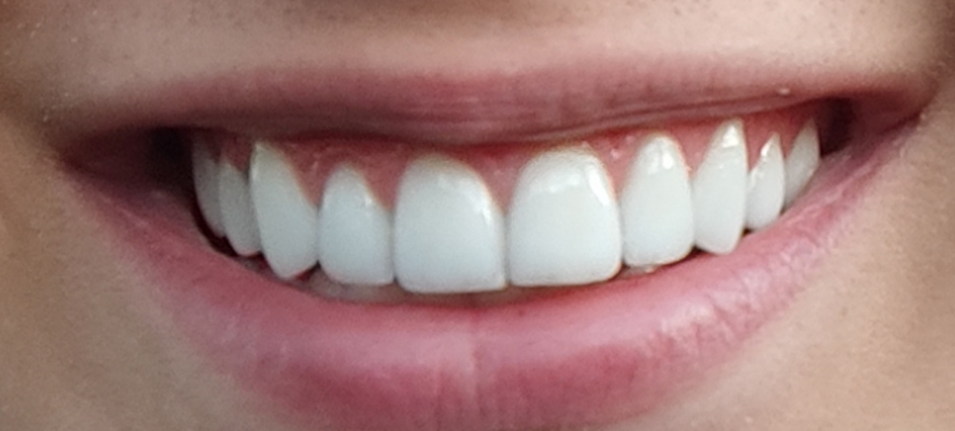 IMG 20221104 064800