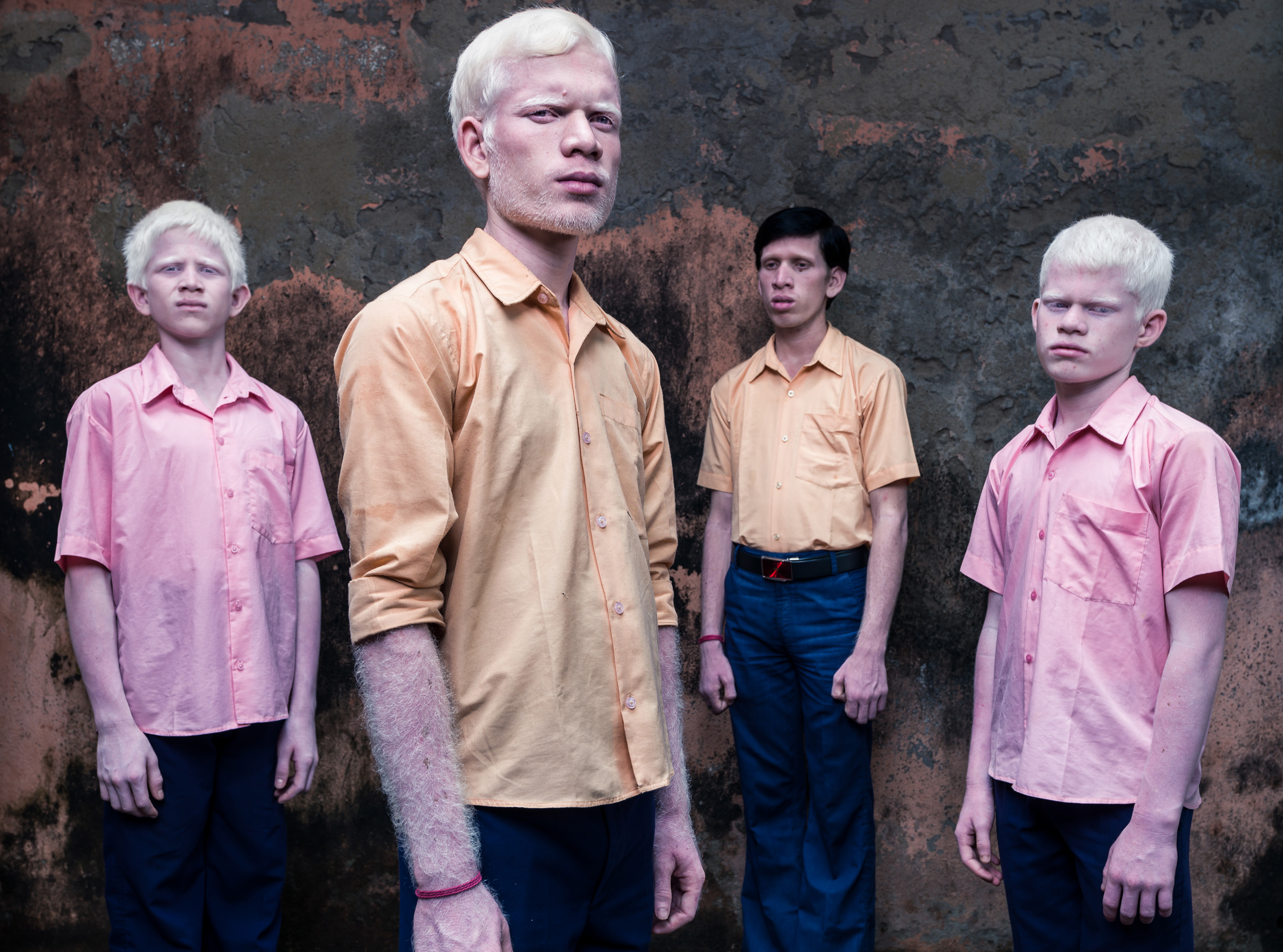 BlindAlbinism 06