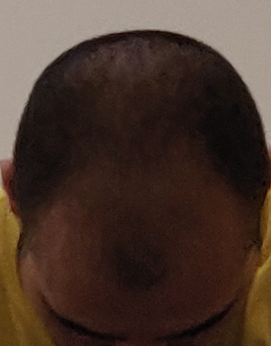 IMG 20221104 174920  01